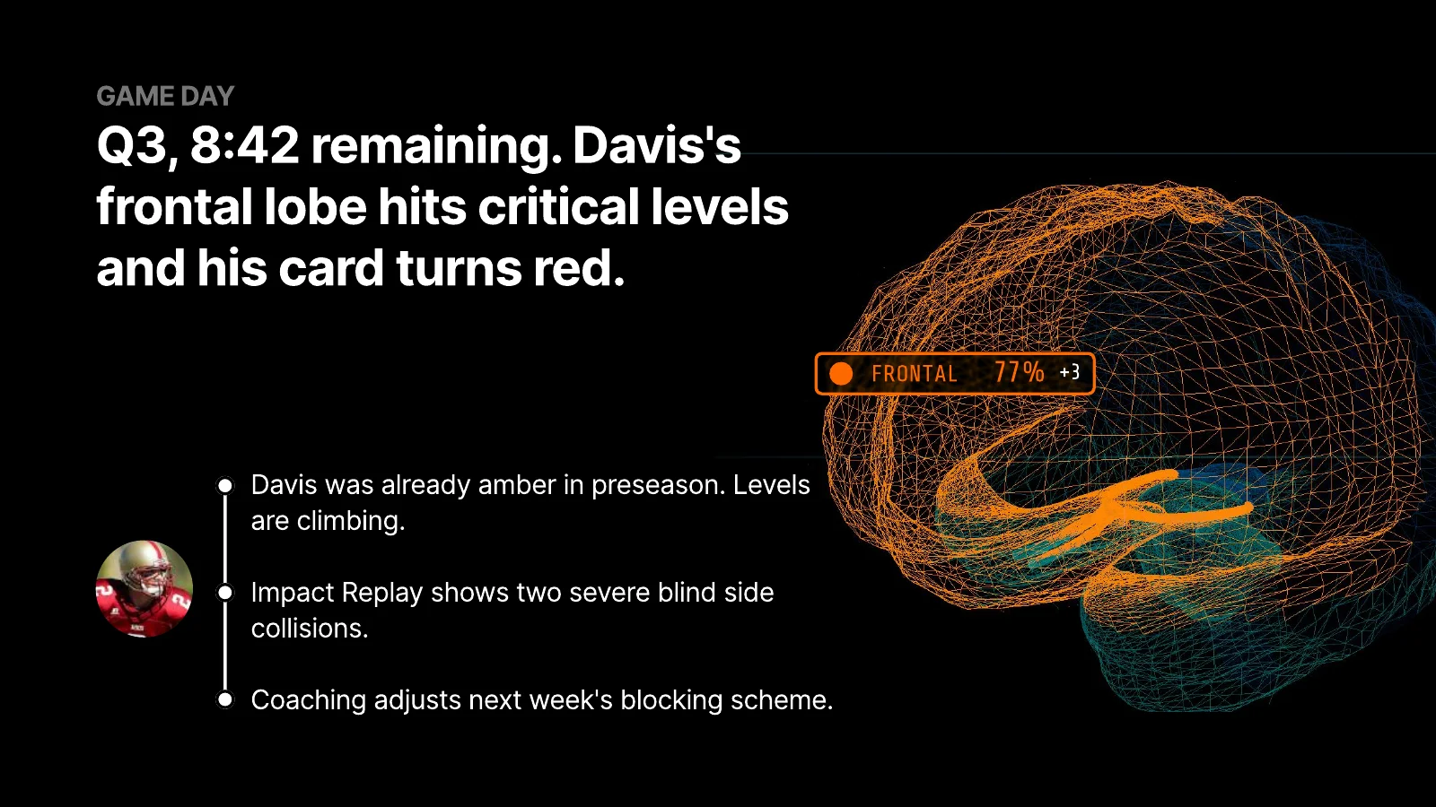 In a live scenario, a player's frontal lobe hits critical levels and his card turns red